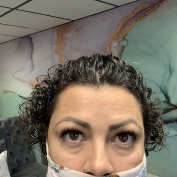 Mitesh Kapadia, MD PhD - Heres a before pic. I had severe hooded eyes.  My under eyes made me look tired all the time. - Ophthalmologists Near Me - Wellesley, Massachusetts