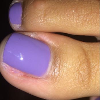 Friend's Nail - They tore my toes up. Pretty disappointed. :( - Nail Salons Near Me - Daly City, California Friend's Nail - They tore my toes up. Pretty disappointed. :( - Nail Salons Near Me - Daly City, California