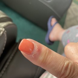 Tore up cuticle