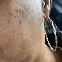 Vogue Threading Lounge - Small scabs and bumps from painful threading