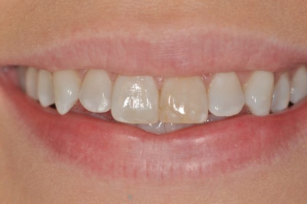 Woodbridge Comfort Dental Care 14605 Potomac Branch Dr Woodbridge