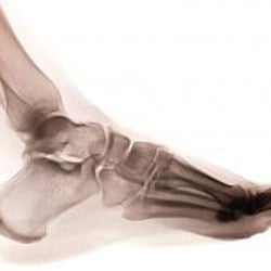 Kansas City Foot and Ankle and The Heel Pain Center - Foot Specialist in Olathe