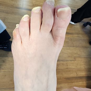 The Foot Zone - Podiatrists Near Me - Tuckahoe, Virginia The Foot Zone - Podiatrists Near Me - Tuckahoe, Virginia