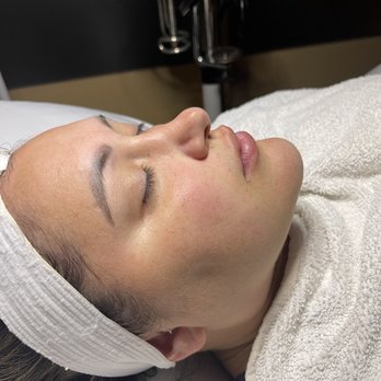 Facelogic Spa - Skin Care Near Me - Chino Hills, California Facelogic Spa - Skin Care Near Me - Chino Hills, California