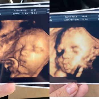 Chubby Cheeks 3D/4D Ultrasound Studio of High Point & Greensboro - Baby #1 and baby #2, 2.5 years apart both at sneak a peek - Ultrasound Imaging Centers Near Me - High Point, North Carolina