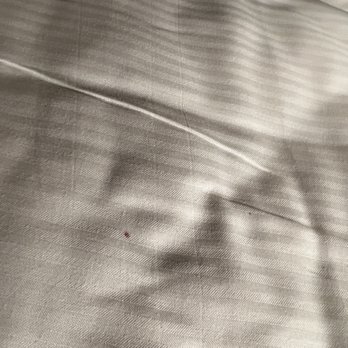 Hilton Chicago O'Hare Airport - Stains on bed sheet - Hotels Near Me - Chicago, Illinois Hilton Chicago O'Hare Airport - Stains on bed sheet - Hotels Near Me - Chicago, Illinois