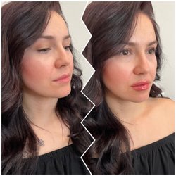 Amara Rejuve Medical Spa And Laser - Hydrated lips