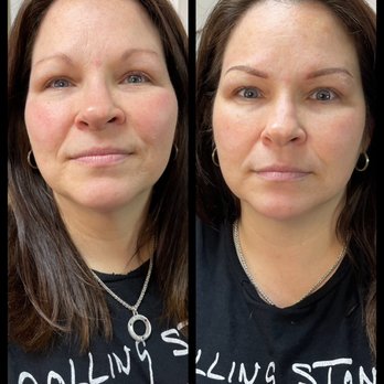 Sandie's Permanent Solutions - She looks younger and so much brighter, truly amazing - Permanent Makeup Near Me - Pittsburgh, Pennsylvania