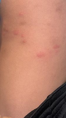 Hotel Indigo Napa Valley, an IHG Hotel by null