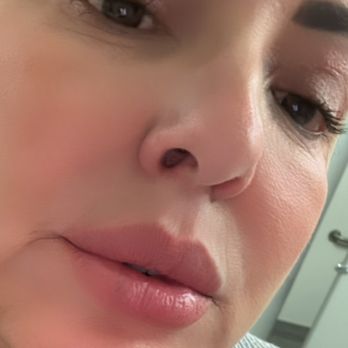 Bella Aesthetics - March 2025 loving my lips natural look - Cosmetics & Beauty Supply Near Me - Rancho Cucamonga, California
