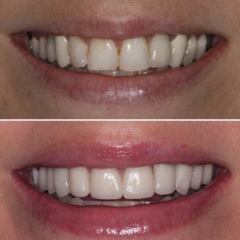 Jared B Williams, DDS - Smile makeover - Cosmetic Dentists Near Me - Mesa, Arizona Jared B Williams, DDS - Smile makeover - Cosmetic Dentists Near Me - Mesa, Arizona