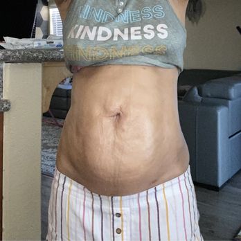 MIA AESTHETICS LAS VEGAS - Updated July 2025 - 96 Photos & 153 Reviews