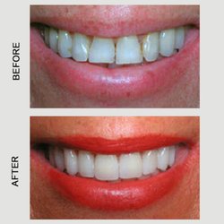 L. Andrew Mutch, DDS