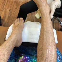 Heel exfoliation Heel exfoliation