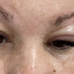 Deka Lash - Reaction 48 hours after lash fill