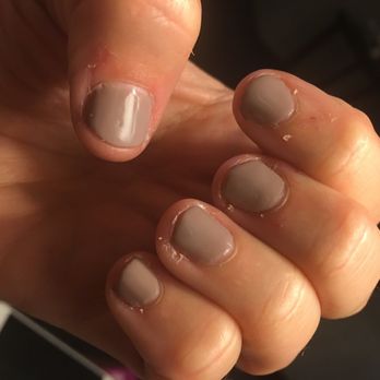 Lotus Nailbar & Spa - Uneven nails, color on the skin and no trimming of skin around the nail bed. - Nail Salons Near Me - Dickson City, Pennsylvania Lotus Nailbar & Spa - Uneven nails, color on the skin and no trimming of skin around the nail bed. - Nail Salons Near Me - Dickson City, Pennsylvania