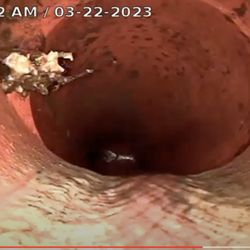 AAA Home & Termite Inspections - sewer scope saved me from a potential waste of money from this bad house I was about to buy. See the roots already in line