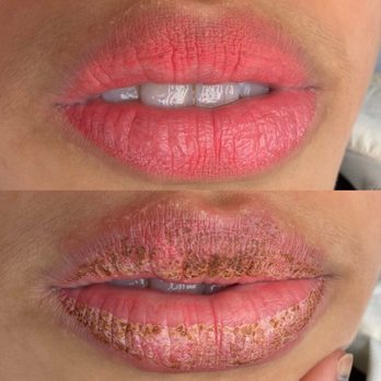 Linh Le - Brows and Lips - Before is immediately after 1st session - Permanent Makeup Near Me - Westminster, California