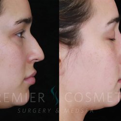 Premier Cosmetic Surgery & MedSpa