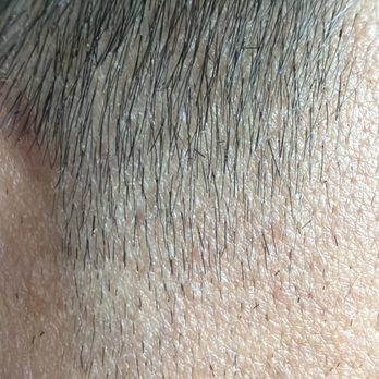 Trenz Salon & Day Spa - Right sideburn. This side isn't bad, but compared to the Left side it doesn't match at all. - Massage Near Me - Harrison, Arkansas Trenz Salon & Day Spa - Right sideburn. This side isn't bad, but compared to the Left side it doesn't match at all. - Massage Near Me - Harrison, Arkansas