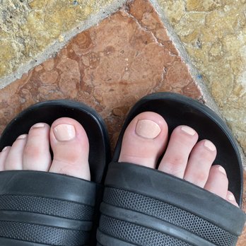 Nail Zone - Right after pedicure. From far away, not bad. Just zoom in... - Nail Salons Near Me - Henderson, Nevada Nail Zone - Right after pedicure. From far away, not bad. Just zoom in... - Nail Salons Near Me - Henderson, Nevada