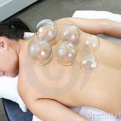 RenEn Acupressure  & Acupuncture - Cupping for sore back