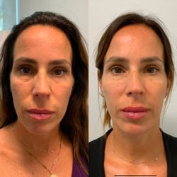 Pure Beauty Medical Spa