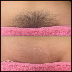 Kay's Esthetics - Brazilian wax