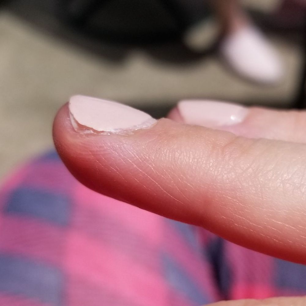 Your Nails - Peeling after day 4 - Nail Salons Near Me - Franklin Park, Illinois