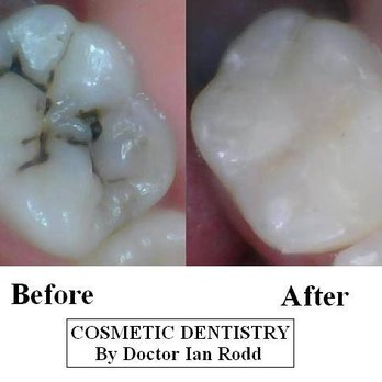 Ian H Rodd, DDS - Cosmetic Dentists Near Me
