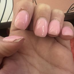 Chipped dip powder after 1 week from Epic Nails in Gilbert. Chipped dip powder after 1 week from Epic Nails in Gilbert.