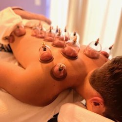Cupping therapy done on a young football player for back pain.