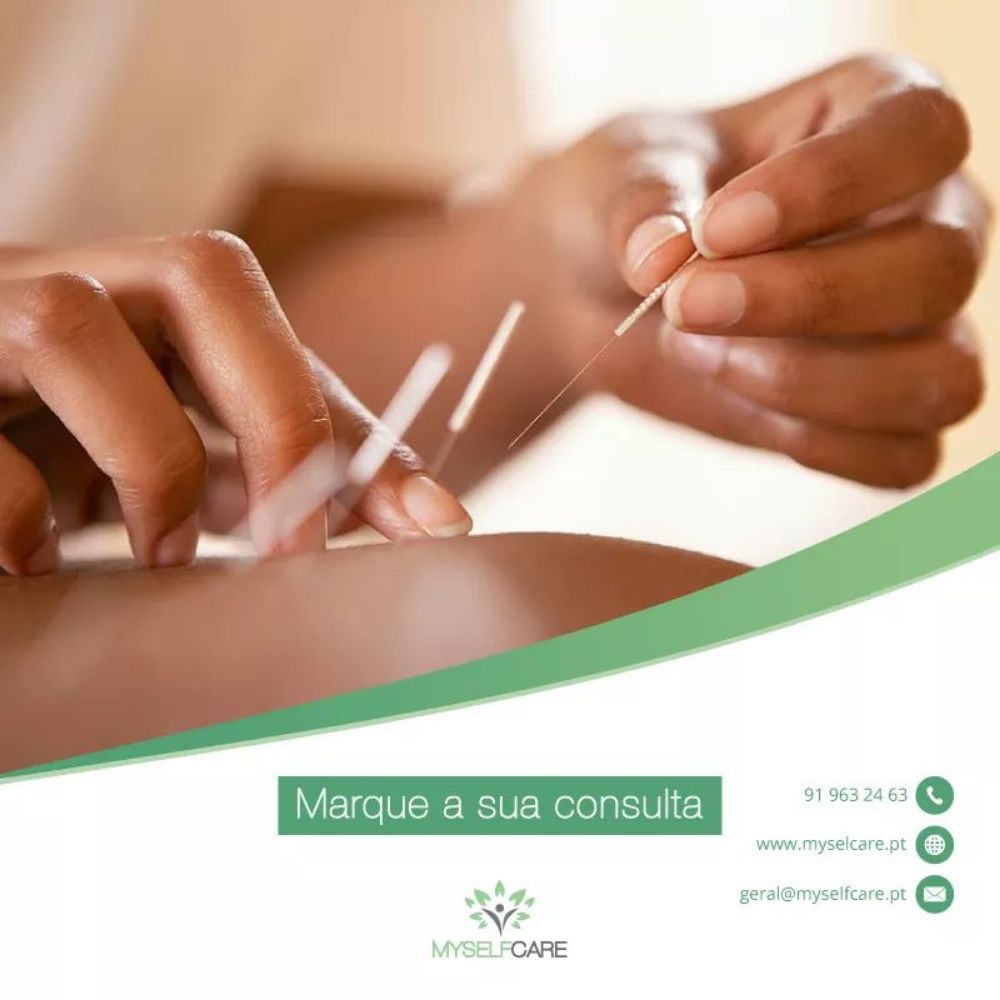 MYSELFCARE Updated October 2024 Av. da República, 1289, Parede, Portugal Acupuncture