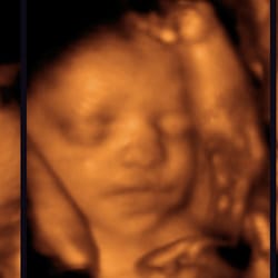 Sneak Peek Studios - Get a peek of your baby today
