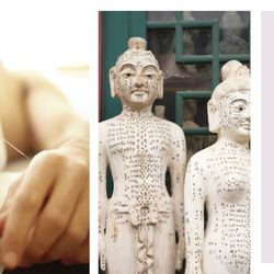 Front Porch Community Acupuncture - Community Acupuncture for Pain Management, Mental Health and more.