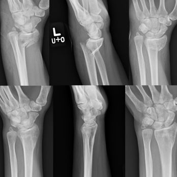 urgent+orthopedic - no surgery, cast for 1 month - Urgent Care Near Me - Glendale, California urgent+orthopedic - no surgery, cast for 1 month - Urgent Care Near Me - Glendale, California