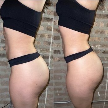 Aesthetics By Dulce K - Cavitation and radio frequency - Waxing Near Me Aesthetics By Dulce K - Cavitation and radio frequency - Waxing Near Me