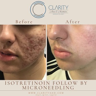 Clarity Acne & Aesthetics, LLC