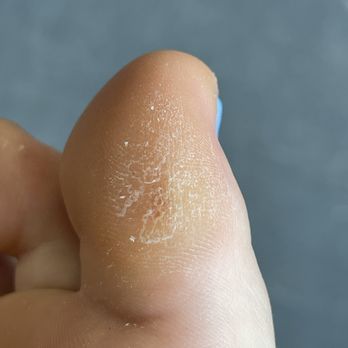 New Star spa&nails - Rough callus!!! NEVER AGAIN - Nail Salons Near Me - Canastota, New York New Star spa&nails - Rough callus!!! NEVER AGAIN - Nail Salons Near Me - Canastota, New York