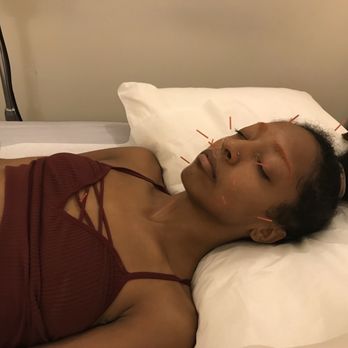 Joyce Leung Acupuncture - Acupuncture Near Me - Newburgh, New York Joyce Leung Acupuncture - Acupuncture Near Me - Newburgh, New York