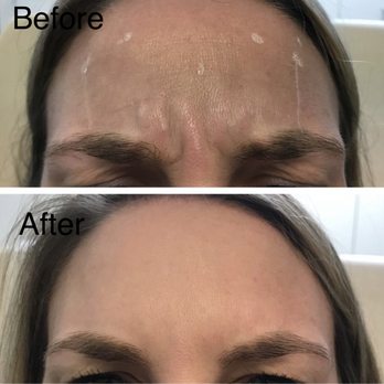 Glouma Esthetics - Estheticians Near Me - Austin, Texas