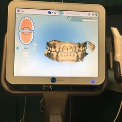 Alfred J Maskeroni - Rescanning because maybe I stopped my treatment and my trays no longer fit.