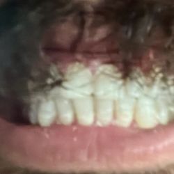 Elgin Healthy Smiles - Killer Canines. Top of the food chain. A nice cleaning from Dr. Duong and staff, and I'm ready to chomp on some meat.