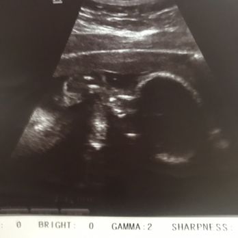 OM Fertility - Baby girl - Fertility Near Me - San Diego, California OM Fertility - Baby girl - Fertility Near Me - San Diego, California