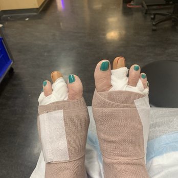 SCOS Orthopedic Specialists - Post-op double foot surgery Dr. Arash Aminian (Ortho Foot Specialist) at SCOS in Laguna Woods, CA. - Orthopedists Near Me - Laguna Woods, California