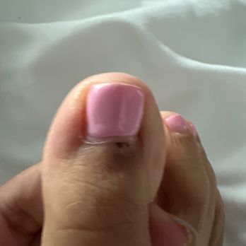 7AM nails - Cuticle injury - Nail Salons Near Me - Chicago, Illinois 7AM nails - Cuticle injury - Nail Salons Near Me - Chicago, Illinois