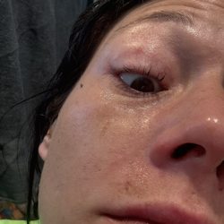 La Vita Day Spa - My eyes r swollen and I have been trying to take these lashes off because they use a cheap adhesive and causes a chemical burn in your eyes