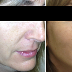 Dr. Bawa & Associates - © Dr. Bawa & Associates
Results may vary.