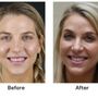 Photo of The Hills Dental Spa