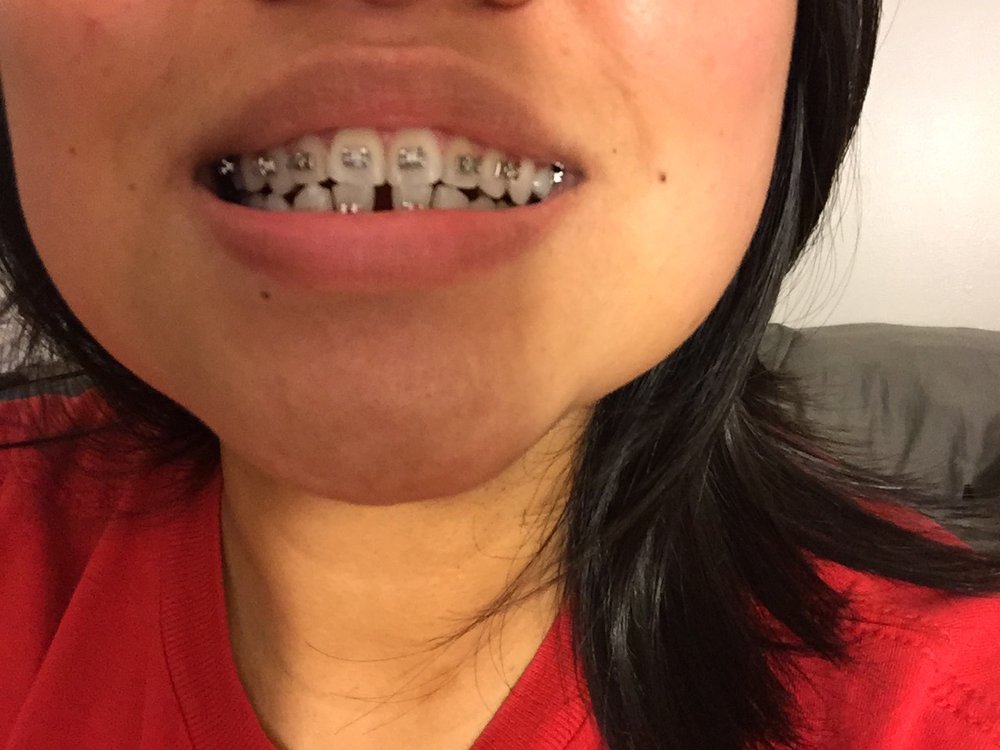 DUNG ORTHODONTICS 22 Photos & 10 Reviews 1600 Kapiolani Blvd